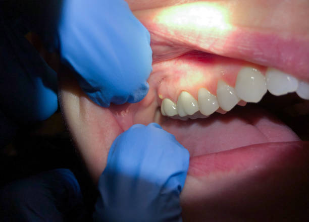 Best Emergency Root Canal Treatment in Lawrenceville, VA