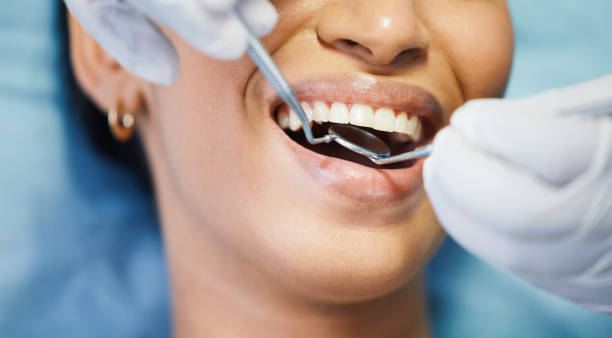 Best Emergency Broken Tooth Repair in Lawrenceville, VA