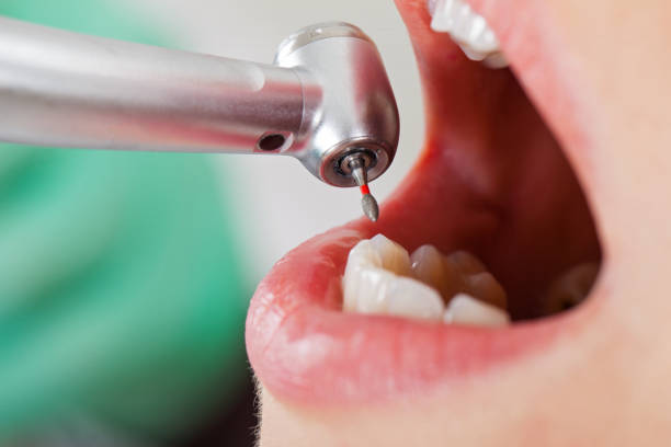 Best Pediatric Emergency Dentist in Lawrenceville, VA